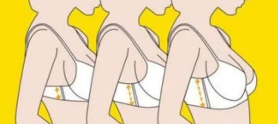 隆胸8.png 隆胸8.png