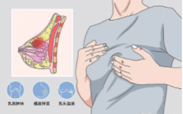 隆胸3 (2).png 隆胸3 (2).png