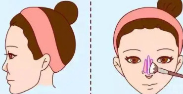 隆鼻10.png 隆鼻10.png