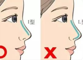 隆鼻3.png 隆鼻3.png