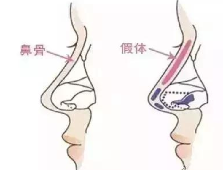 圖片.png 圖片.png