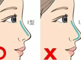 隆鼻8.png 隆鼻8.png