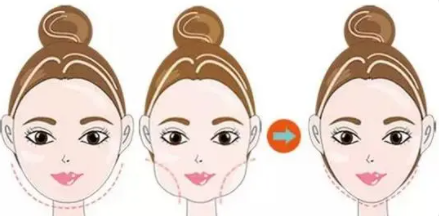 面部溶脂16 (2).png 面部溶脂16 (2).png