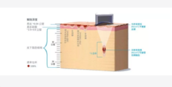 面部溶脂14 (2).png 面部溶脂14 (2).png