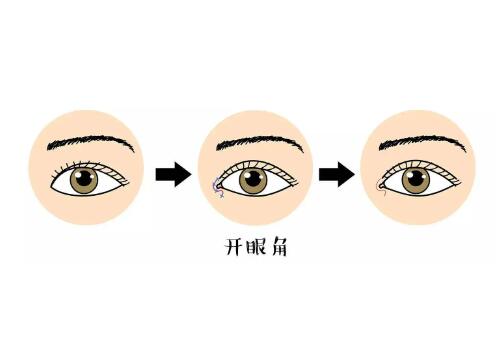 開眼角2.jpg